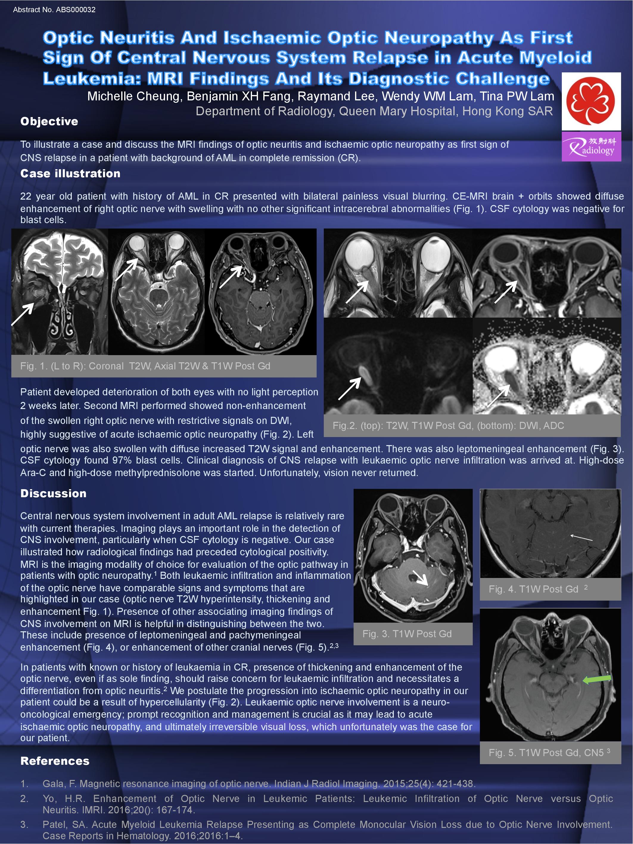 radiology poster presentation 2022